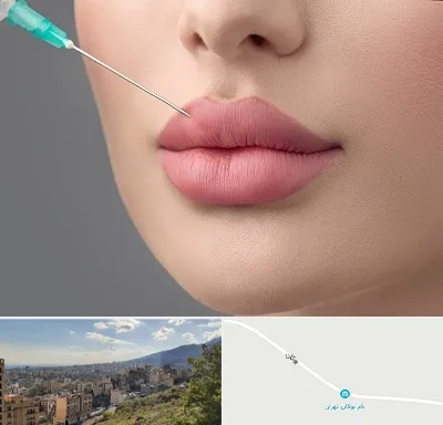 کلینیک ژل لب روسی در بوکان تهران