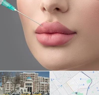 کلینیک ژل لب روسی در طلاب مشهد