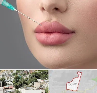 کلینیک ژل لب روسی در جماران