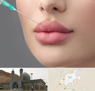 کلینیک ژل لب روسی در شهرضا