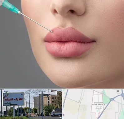 کلینیک ژل لب روسی در فاز یک اندیشه