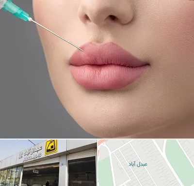 کلینیک ژل لب روسی در عبدل آباد