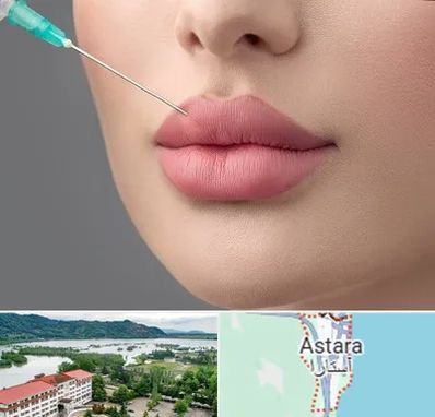 کلینیک ژل لب روسی در آستارا