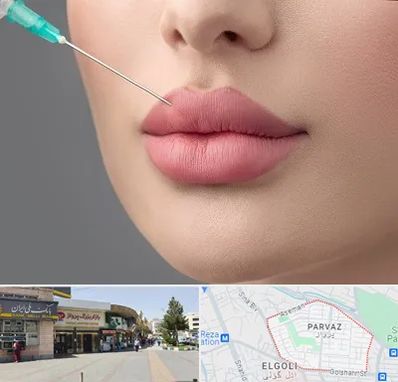 کلینیک ژل لب روسی در پرواز تبریز