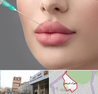 کلینیک ژل لب روسی در شهرک شریعتی