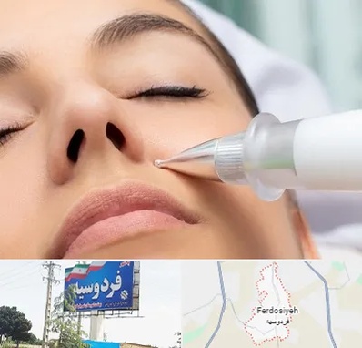 پلاسما جت بینی در فردوسیه شهریار