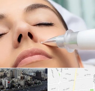 پلاسما جت بینی در زرتشت