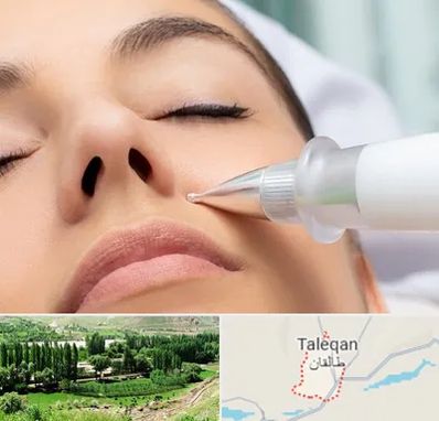 پلاسما جت بینی در طالقان