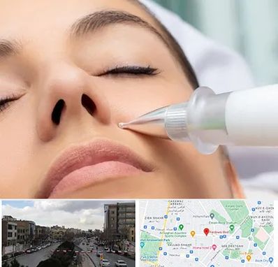 پلاسما جت بینی در بلوار فردوسی مشهد