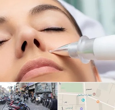 پلاسما جت بینی در چهارراه استانبول
