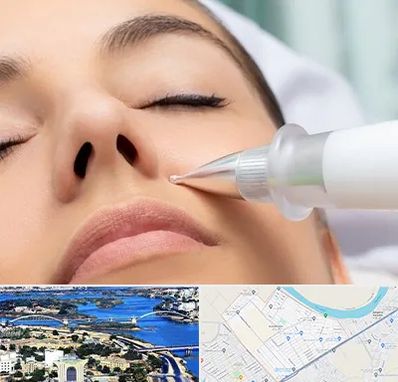 پلاسما جت بینی در کوروش اهواز