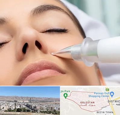 پلاسما جت بینی در شهرک گلستان شیراز