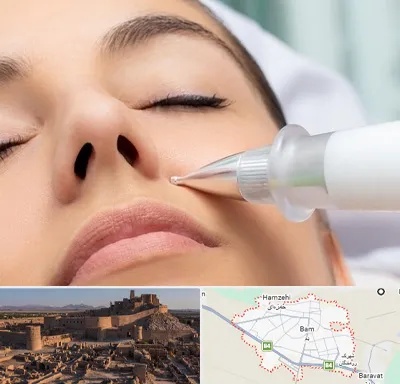 پلاسما جت بینی در بم