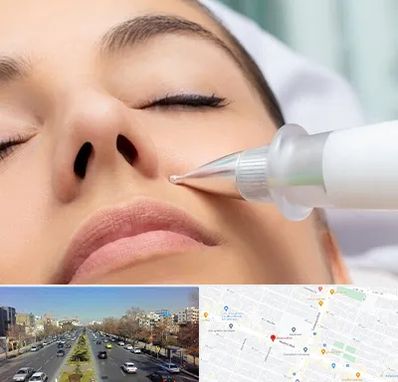 پلاسما جت بینی در بلوار معلم مشهد