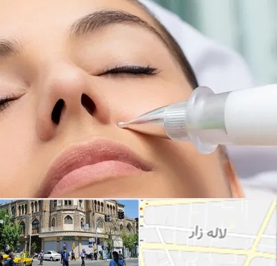 پلاسما جت بینی در لاله زار