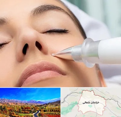 پلاسما جت بینی در خراسان شمالی