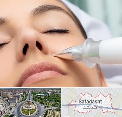 پلاسما جت بینی در صفادشت