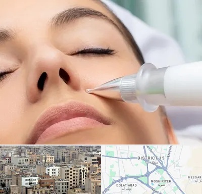 پلاسما جت بینی در جنوب شرق تهران
