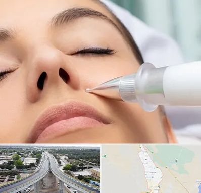 پلاسما جت بینی در اندیمشک