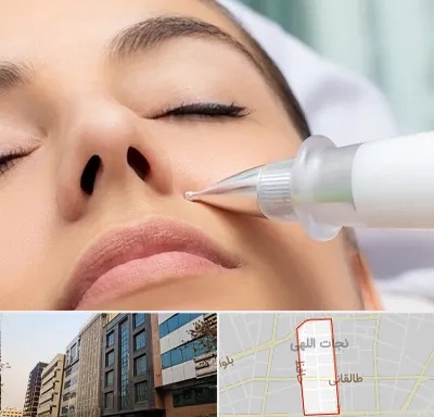 پلاسما جت بینی در نجات اللهی
