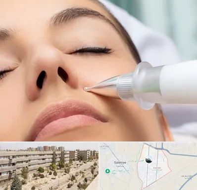 پلاسما جت بینی در واوان اسلامشهر