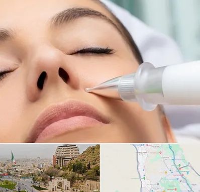 پلاسما جت بینی در فرهنگ شهر شیراز