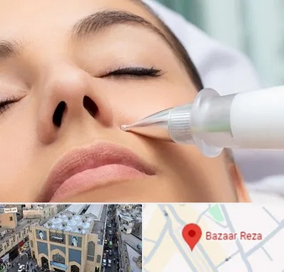 پلاسما جت بینی در بازار رضا مشهد