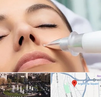 پلاسما جت بینی در آرژانتین