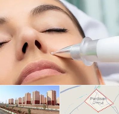 پلاسما جت بینی در پردیسان قم