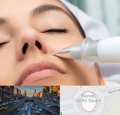 پلاسما جت بینی در نواب