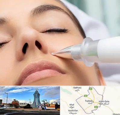 پلاسما جت بینی در تایباد