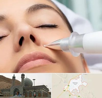 پلاسما جت بینی در شهرضا