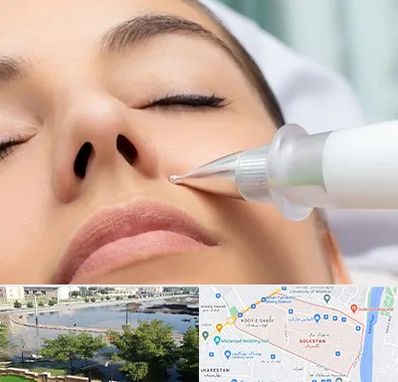 پلاسما جت بینی در گلستان اهواز