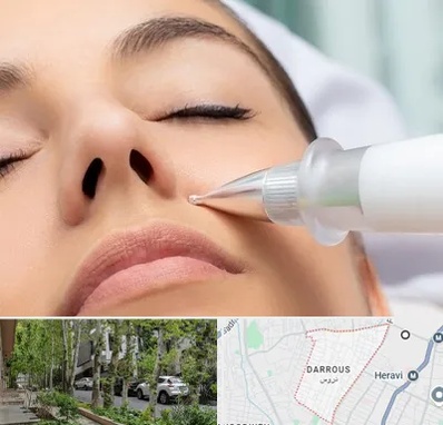 پلاسما جت بینی در دروس