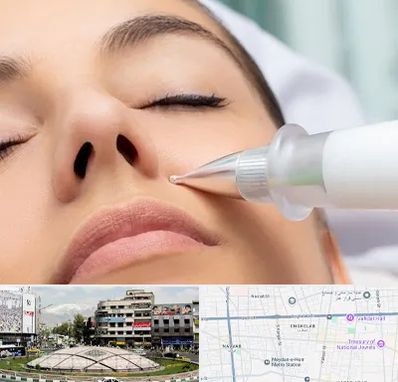 پلاسما جت بینی در مرکز تهران