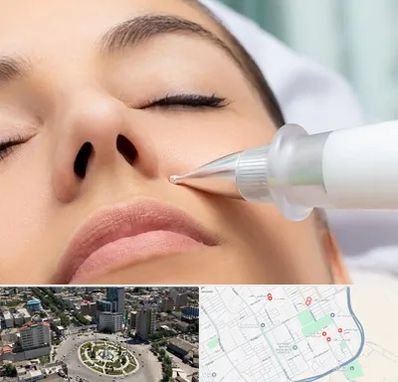 پلاسما جت بینی در زرافشان اسلامشهر