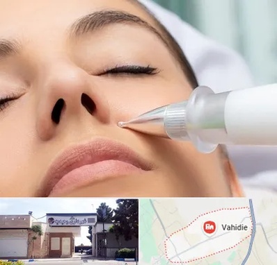 پلاسما جت بینی در وحیدیه شهریار