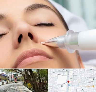 پلاسما جت بینی در خیابان توحید اصفهان