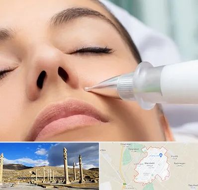 پلاسما جت بینی در مرودشت