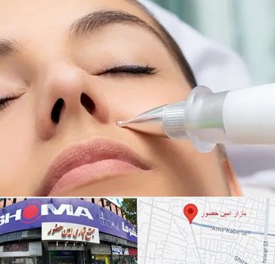 پلاسما جت بینی در امین حضور