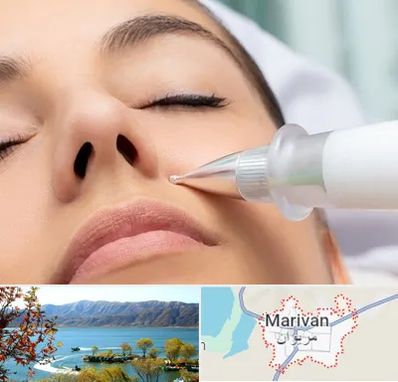 پلاسما جت بینی در مریوان