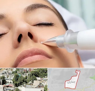 پلاسما جت بینی در جماران