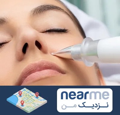 پلاسما جت بینی در نزدیک من