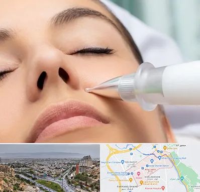 پلاسما جت بینی در معالی آباد شیراز