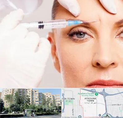 مزوژل در آپادانا