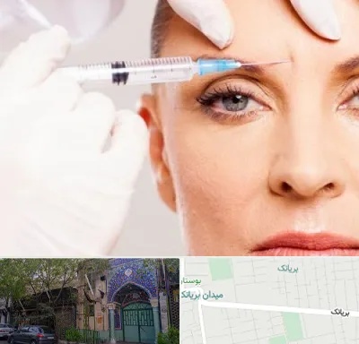 مزوژل در بریانک