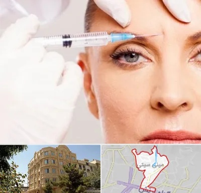 مزوژل در مینی سیتی
