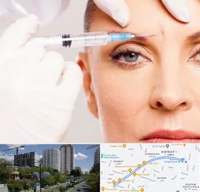 مزوژل در اندرزگو