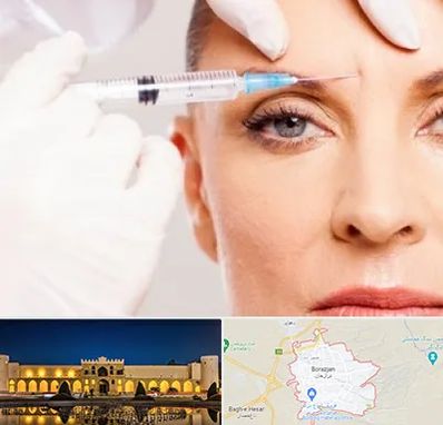 مزوژل در برازجان