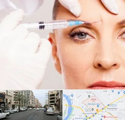 مزوژل در زیتون کارمندی اهواز